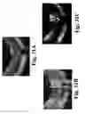Fig. 32 - Dynamic motion contrast and transverse flow estimation using optical coherence tomography