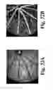 Fig. 33 - Dynamic motion contrast and transverse flow estimation using optical coherence tomography