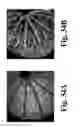 Fig. 35 - Dynamic motion contrast and transverse flow estimation using optical coherence tomography