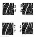 Fig. 37 - Dynamic motion contrast and transverse flow estimation using optical coherence tomography