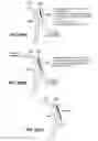 Fig. 16 - Devices and method for accelerometer-based characterization of cardiac synchrony and dyssynchrony