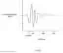 Fig. 35 - Devices and method for accelerometer-based characterization of cardiac synchrony and dyssynchrony