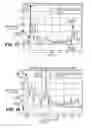 Fig. 42 - Devices and method for accelerometer-based characterization of cardiac synchrony and dyssynchrony