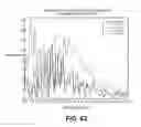 Fig. 46 - Devices and method for accelerometer-based characterization of cardiac synchrony and dyssynchrony