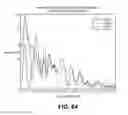 Fig. 47 - Devices and method for accelerometer-based characterization of cardiac synchrony and dyssynchrony