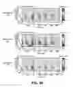 Fig. 49 - Devices and method for accelerometer-based characterization of cardiac synchrony and dyssynchrony