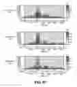 Fig. 50 - Devices and method for accelerometer-based characterization of cardiac synchrony and dyssynchrony