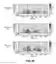 Fig. 51 - Devices and method for accelerometer-based characterization of cardiac synchrony and dyssynchrony