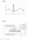 Fig. 02 - Method for generating a trigger signal by an EKG signal as well as an EKG measuring apparatus and a magnetic resonance device