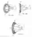 Fig. 65 - Tissue visualization device