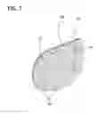 Fig. 08 - Compression device with structural support features