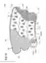 Fig. 21 - Compression device with structural support features