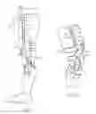 Fig. 06 - Orthosis support