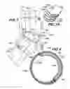 Fig. 06 - Elbow Brace