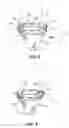 Fig. 04 - SATIATION POUCHES AND METHODS OF USE