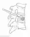 Fig. 01 - Methods of treating degenerative bone conditions
