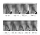 Fig. 03 - Methods of treating degenerative bone conditions