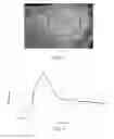 Fig. 06 - Methods of treating degenerative bone conditions