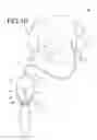 Fig. 11 - Gas mist mask device
