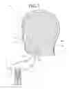 Fig. 02 - Gas mist pressure bath device