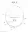 Fig. 03 - Gas mist pressure bath device