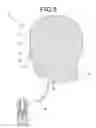 Fig. 09 - Gas mist pressure bath device