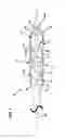 Fig. 02 - Catheter assembly
