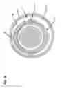 Fig. 15 - Catheter assembly