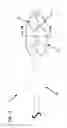 Fig. 16 - Catheter assembly