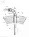 Fig. 01 - GASTRIC PORT SYSTEM