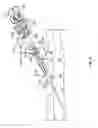 Fig. 05 - Anchoring a medical instrument