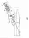 Fig. 07 - Anchoring a medical instrument