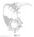 Fig. 12 - NEEDLE PROTECTIVE DEVICE