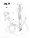 Fig. 06 - Subdural evacuation port aspiration device