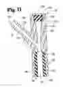 Fig. 09 - Subdural evacuation port aspiration device