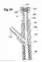 Fig. 12 - Subdural evacuation port aspiration device
