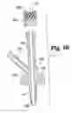 Fig. 16 - Subdural evacuation port aspiration device