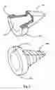 Fig. 04 - CAPSULAR URINARY CATHETER