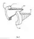 Fig. 06 - CAPSULAR URINARY CATHETER