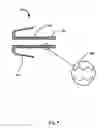Fig. 10 - CAPSULAR URINARY CATHETER