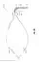 Fig. 06 - STEERABLE SURGICAL SNARE AND METHOD OF USE