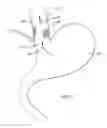 Fig. 02 - Methods and systems for determining physiologic characteristics for treatment of the esophagus