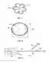 Fig. 03 - Methods and systems for determining physiologic characteristics for treatment of the esophagus