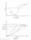 Fig. 13 - Methods and systems for determining physiologic characteristics for treatment of the esophagus