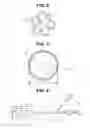 Fig. 03 - Methods and systems for treatment of tissue in a body lumen