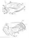 Fig. 09 - Multi-locking external fixation clamp