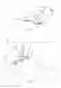 Fig. 03 - Resection instrument