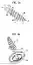 Fig. 03 - System and method for joint resurface repair
