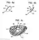 Fig. 04 - System and method for joint resurface repair