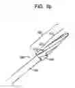 Fig. 09 - System and method for joint resurface repair